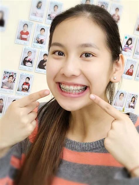 pinay brace porn|'pinay braces' Search .